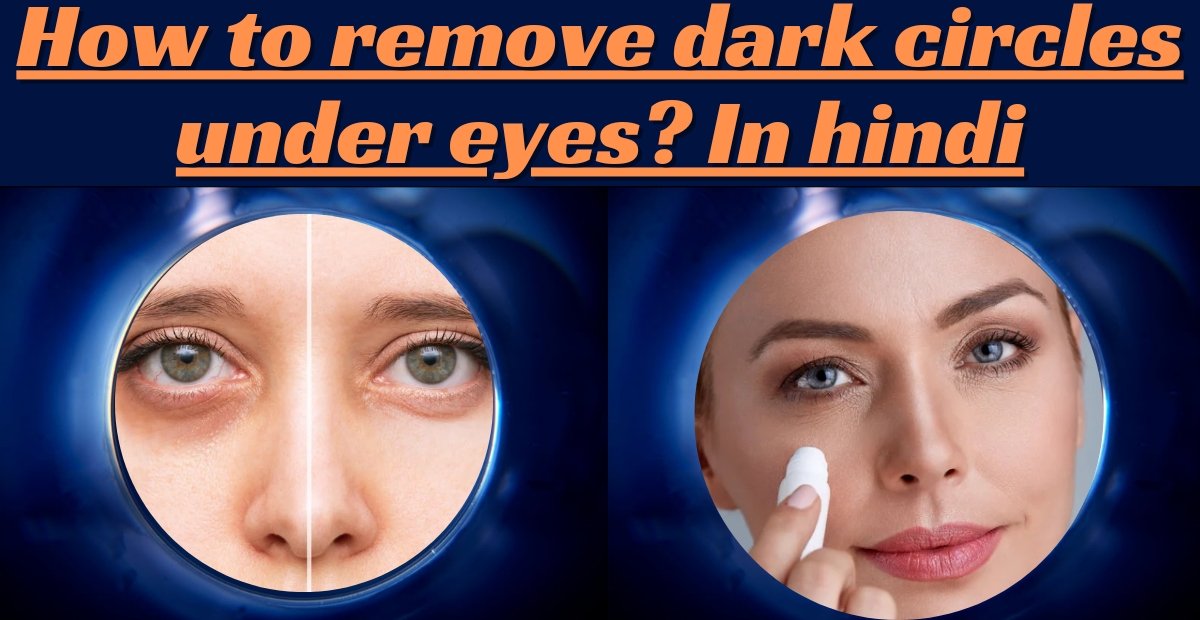 How to remove dark circles under eyes In hindi