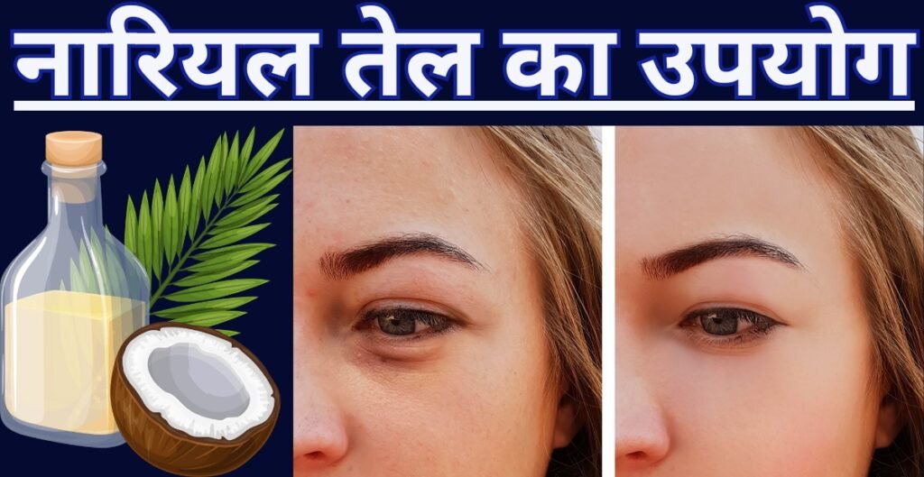 How to remove dark circles under eyes? In hindi