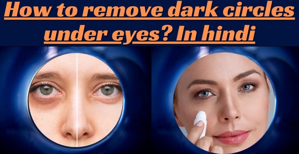 How to remove dark circles under eyes? In hindi